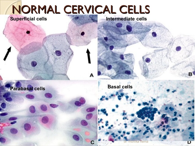 cervical-cytopathology-32-638.jpg