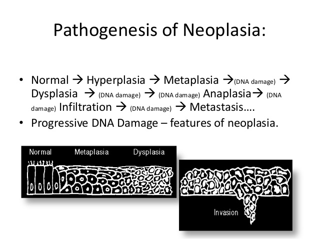 neoplasma-1-15-638.jpg