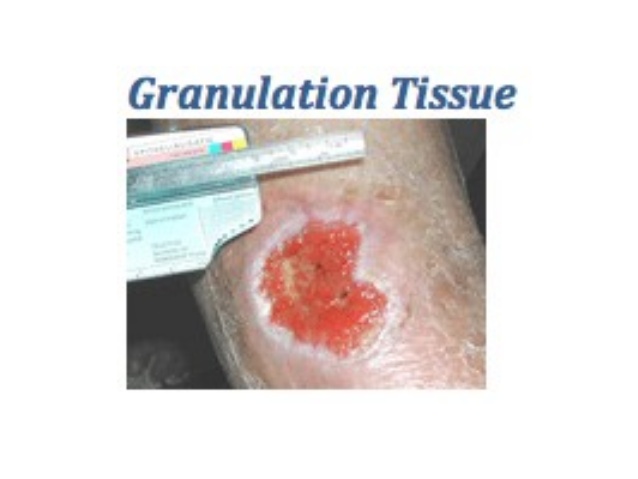 tissue-repair-regeneration-and-wound-healing-1-22-638.jpg